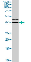 ISLET-1 / ISL1 Antibody - ISL1 monoclonal antibody (M01), clone 1A3. Western Blot analysis of ISL1 expression in HeLa NE.