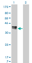 ISLET-1 / ISL1 Antibody - Western Blot analysis of ISL1 expression in transfected 293T cell line by ISL1 monoclonal antibody (M01), clone 1A3.Lane 1: ISL1 transfected lysate(38.7 KDa).Lane 2: Non-transfected lysate.
