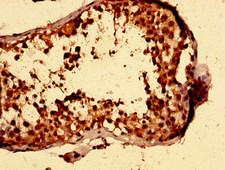 ISLET-1 / ISL1 Antibody - Immunohistochemistry image of paraffin-embedded human testis tissue at a dilution of 1:100