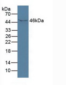 ISLR Antibody - Western Blot; Sample:Human Serum.