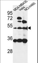 ISLR Antibody - ISLR Antibody western blot of MDA-MB435,HeLa,NCI-H460 cell line lysates (35 ug/lane). The ISLR antibody detected the ISLR protein (arrow).
