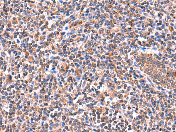 ISM1 Antibody - Immunohistochemistry of paraffin-embedded Human tonsil tissue  using ISM1 Polyclonal Antibody at dilution of 1:60(×200)
