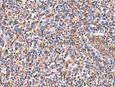 ISM1 Antibody - Immunohistochemistry of paraffin-embedded Human tonsil tissue  using ISM1 Polyclonal Antibody at dilution of 1:60(×200)