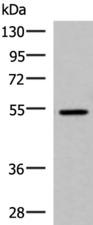 ISM1 Antibody - Western blot analysis of HepG2 cell lysate  using ISM1 Polyclonal Antibody at dilution of 1:1000