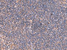 ISM1 Antibody - Immunohistochemistry of paraffin-embedded Human tonsil tissue  using ISM1 Polyclonal Antibody at dilution of 1:40(×200)