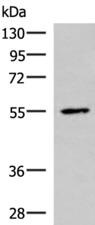 ISM1 Antibody - Western blot analysis of HepG2 cell lysate  using ISM1 Polyclonal Antibody at dilution of 1:1000