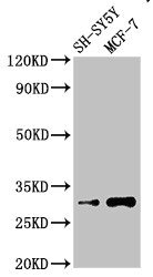 ISOC1 Antibody - Positive Western Blot detected in SH-SY5Y whole cell lysate, MCF-7 whole cell lysate. All lanes: ISOC1 antibody at 3.5 µg/ml Secondary Goat polyclonal to rabbit IgG at 1/50000 dilution. Predicted band size: 33 KDa. Observed band size: 33 KDa