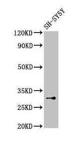 ISOC1 Antibody - Western Blot Positive WB detected in: SH-SY5Y whole cell lysate All lanes: ISOC1 antibody at 3.5µg/ml Secondary Goat polyclonal to rabbit IgG at 1/50000 dilution Predicted band size: 33 kDa Observed band size: 33 kDa