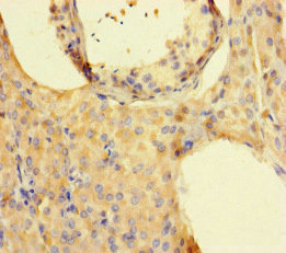 ISPD / Nip Antibody - Immunohistochemistry of paraffin-embedded human testis tissue at dilution of 1:100