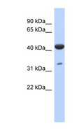 ISPD / Nip Antibody - ISPD antibody Western blot of Fetal Lung lysate. This image was taken for the unconjugated form of this product. Other forms have not been tested.