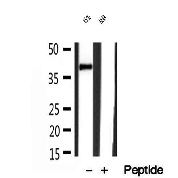 IST1 Antibody - Western blot analysis of extracts of A549 cells using IST1 antibody.
