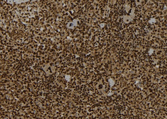 IST1 Antibody - 1:100 staining mouse spleen tissue by IHC-P. The sample was formaldehyde fixed and a heat mediated antigen retrieval step in citrate buffer was performed. The sample was then blocked and incubated with the antibody for 1.5 hours at 22°C. An HRP conjugated goat anti-rabbit antibody was used as the secondary.