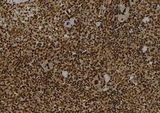 IST1 Antibody - 1:100 staining mouse spleen tissue by IHC-P. The sample was formaldehyde fixed and a heat mediated antigen retrieval step in citrate buffer was performed. The sample was then blocked and incubated with the antibody for 1.5 hours at 22°C. An HRP conjugated goat anti-rabbit antibody was used as the secondary.