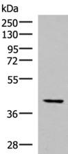 IST1 Antibody - Western blot analysis of Hela cell lysate  using IST1 Polyclonal Antibody at dilution of 1:1000