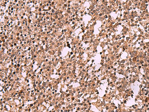 IST1 Antibody - Immunohistochemistry of paraffin-embedded Human tonsil tissue  using IST1 Polyclonal Antibody at dilution of 1:40(×200)