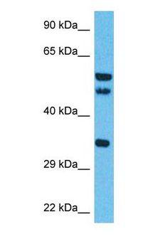 ISY1 Antibody - Western blot of ISY1 Antibody with human Thymus Tumor lysate.  This image was taken for the unconjugated form of this product. Other forms have not been tested.