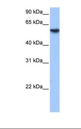 ISYNA1 Antibody - Fetal lung cell lysate. Antibody concentration: 1.0 ug/ml. Gel concentration: 12%.  This image was taken for the unconjugated form of this product. Other forms have not been tested.
