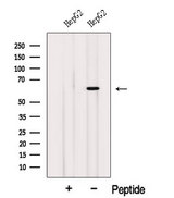 ISYNA1 Antibody - Western blot analysis of extracts of HepG2 cells using ISYNA1 antibody. The lane on the left was treated with blocking peptide.