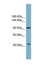 ITCH / AIP4 Antibody - ITCH antibody Western blot of COLO205 cell lysate. This image was taken for the unconjugated form of this product. Other forms have not been tested.