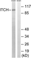 ITCH / AIP4 Antibody - Western blot analysis of lysates from mouse brain, using ITCH Antibody. The lane on the right is blocked with the synthesized peptide.