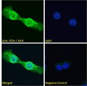 ITCH / AIP4 Antibody - ITCH / AIP4 antibody immunofluorescence analysis of paraformaldehyde fixed A431 cells, permeabilized with 0.15% Triton. Primary incubation 1hr (10ug/ml) followed by Alexa Fluor 488 secondary antibody (2ug/ml), showing nuclear and vesicle staining. The nuclear stain is DAPI (blue). Negative control: Unimmunized goat IgG (10ug/ml) followed by Alexa Fluor 488 secondary antibody (2ug/ml).
