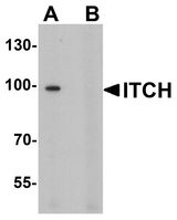 ITCH / AIP4 Antibody - Western blot analysis of ITCH in 3T3 cell lysate with ITCH antibody at 1 ug/ml in (A) the absence and (B) the presence of blocking peptide.