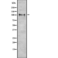 ITCH / AIP4 Antibody - Western blot analysis ITCH using LOVO cells whole cells lysates