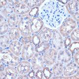 ITCH / AIP4 Antibody - Immunohistochemistry of paraffin-embedded Rat kidney using ITCH Polyclonal Antibody at dilution of 1:50 (40x lens).