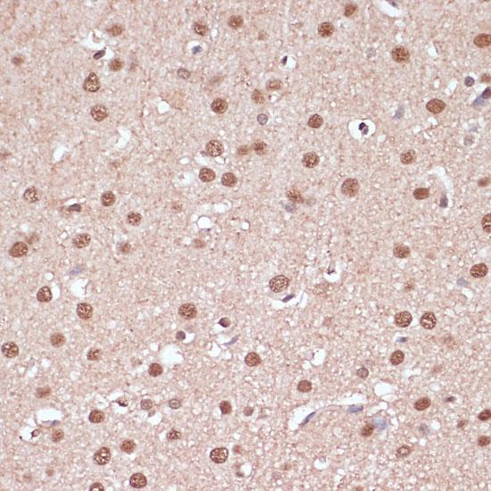 ITCH / AIP4 Antibody - Immunohistochemistry of paraffin-embedded Rat brain using ITCH Polyclonal Antibody at dilution of 1:100 (40x lens).