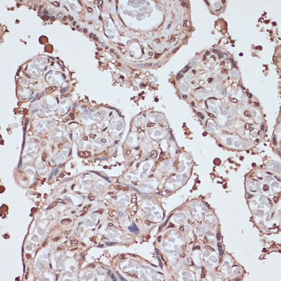 ITCH / AIP4 Antibody - Immunohistochemistry of paraffin-embedded Human placenta using ITCH Polyclonal Antibody at dilution of 1:100 (40x lens).