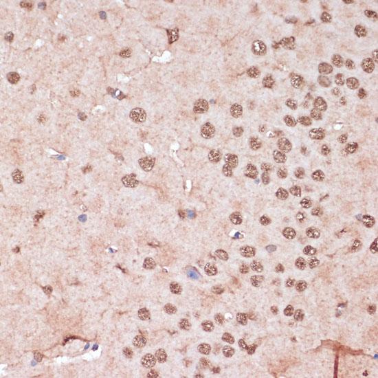 ITCH / AIP4 Antibody - Immunohistochemistry of paraffin-embedded Mouse brain using ITCH Polyclonal Antibody at dilution of 1:100 (40x lens).