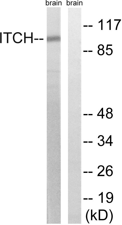 ITCH / AIP4 Antibody - Western blot analysis of extracts from mouse brain cells, using ITCH (Ab-420) antibody.