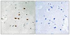 ITCH / AIP4 Antibody - Immunohistochemistry analysis of paraffin-embedded human brain, using ITCH (Phospho-Tyr420) Antibody. The picture on the right is blocked with the phospho peptide.