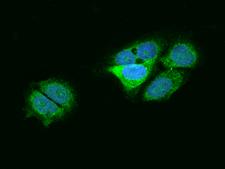 ITCH / AIP4 Antibody - Immunofluorescence staining of ITCH in MCF7 cells. Cells were fixed with 4% PFA, permeabilzed with 0.3% Triton X-100 in PBS, blocked with 10% serum, and incubated with rabbit anti-Human ITCH polyclonal antibody (dilution ratio 1:200) at 4°C overnight. Then cells were stained with the Alexa Fluor 488-conjugated Goat Anti-rabbit IgG secondary antibody (green) and counterstained with DAPI (blue). Positive staining was localized to Cytoplasm.