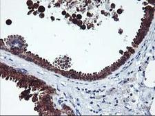 ITFG2 Antibody - IHC of paraffin-embedded Human breast tissue using anti-ITFG2 mouse monoclonal antibody.