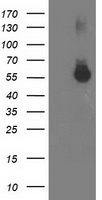 ITFG2 Antibody - HEK293T cells were transfected with the pCMV6-ENTRY control (Left lane) or pCMV6-ENTRY ITFG2 (Right lane) cDNA for 48 hrs and lysed. Equivalent amounts of cell lysates (5 ug per lane) were separated by SDS-PAGE and immunoblotted with anti-ITFG2.