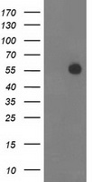 ITFG2 Antibody - HEK293T cells were transfected with the pCMV6-ENTRY control (Left lane) or pCMV6-ENTRY ITFG2 (Right lane) cDNA for 48 hrs and lysed. Equivalent amounts of cell lysates (5 ug per lane) were separated by SDS-PAGE and immunoblotted with anti-ITFG2.