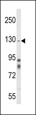 ITGA1/CD49a/Integrin Alpha 1 Antibody - Western blot of ITGA1 Antibody in mouse cerebellum tissue lysates (35 ug/lane). ITGA1 (arrow) was detected using the purified antibody.