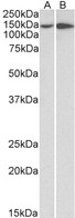 ITGA1/CD49a/Integrin Alpha 1 Antibody - Goat anti-ITGA1 / VLA1 Antibody (0.5µg/ml) staining of HeLa (A) and HepG2 (B) lysates (35µg protein in RIPA buffer). Primary incubation was 1 hour. Detected by chemiluminescencence.