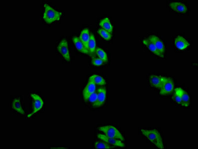 ITGA1/CD49a/Integrin Alpha 1 Antibody - Immunofluorescence staining of HepG2 cells with ITGA1 Antibody at 1:200, counter-stained with DAPI. The cells were fixed in 4% formaldehyde, permeabilized using 0.2% Triton X-100 and blocked in 10% normal Goat Serum. The cells were then incubated with the antibody overnight at 4°C. The secondary antibody was Alexa Fluor 488-congugated AffiniPure Goat Anti-Rabbit IgG(H+L).