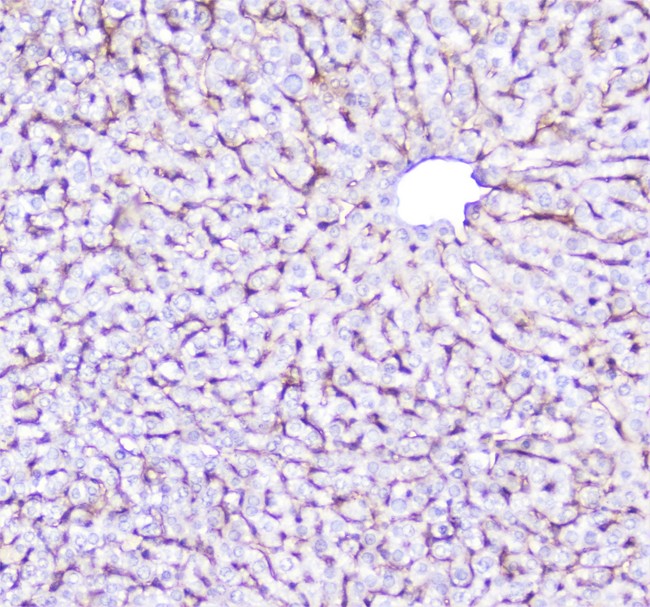 ITGA1/CD49a/Integrin Alpha 1 Antibody - IHC analysis of Integrin alpha 1 using anti-Integrin alpha 1 antibody. Integrin alpha 1 was detected in paraffin-embedded section of mouse liver tissue. Heat mediated antigen retrieval was performed in citrate buffer (pH6, epitope retrieval solution) for 20 mins. The tissue section was blocked with 10% goat serum. The tissue section was then incubated with 2µg/ml rabbit anti-Integrin alpha 1 Antibody overnight at 4°C. Biotinylated goat anti-rabbit IgG was used as secondary antibody and incubated for 30 minutes at 37°C. The tissue section was developed using Strepavidin-Biotin-Complex (SABC) with DAB as the chromogen.