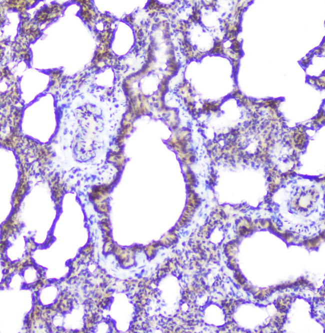 ITGA1/CD49a/Integrin Alpha 1 Antibody - IHC analysis of Integrin alpha 1 using anti-Integrin alpha 1 antibody. Integrin alpha 1 was detected in paraffin-embedded section of rat lung tissue. Heat mediated antigen retrieval was performed in citrate buffer (pH6, epitope retrieval solution) for 20 mins. The tissue section was blocked with 10% goat serum. The tissue section was then incubated with 2µg/ml rabbit anti-Integrin alpha 1 Antibody overnight at 4°C. Biotinylated goat anti-rabbit IgG was used as secondary antibody and incubated for 30 minutes at 37°C. The tissue section was developed using Strepavidin-Biotin-Complex (SABC) with DAB as the chromogen.