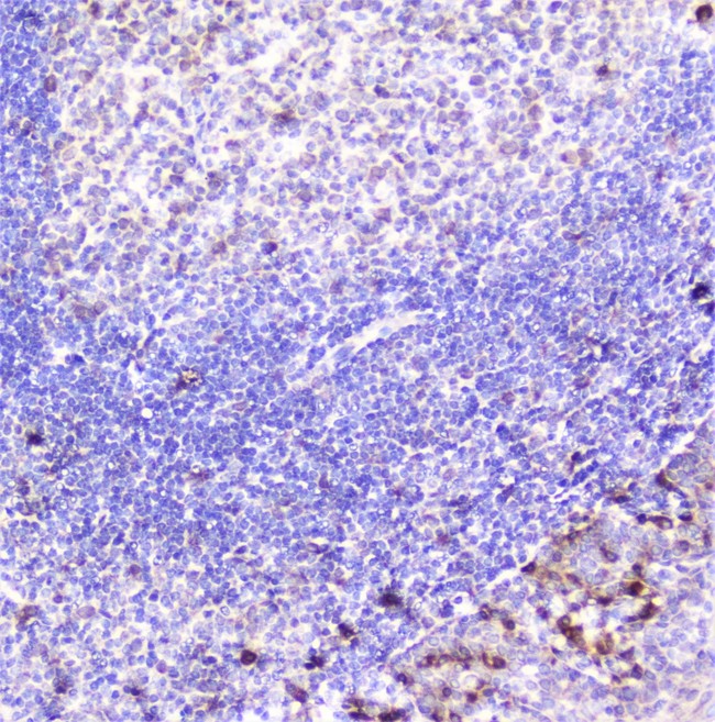 ITGA1/CD49a/Integrin Alpha 1 Antibody - IHC analysis of Integrin alpha 1 using anti-Integrin alpha 1 antibody. Integrin alpha 1 was detected in paraffin-embedded section of human tonsil tissue. Heat mediated antigen retrieval was performed in citrate buffer (pH6, epitope retrieval solution) for 20 mins. The tissue section was blocked with 10% goat serum. The tissue section was then incubated with 2µg/ml rabbit anti-Integrin alpha 1 Antibody overnight at 4°C. Biotinylated goat anti-rabbit IgG was used as secondary antibody and incubated for 30 minutes at 37°C. The tissue section was developed using Strepavidin-Biotin-Complex (SABC) with DAB as the chromogen.