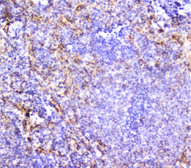 ITGA1/CD49a/Integrin Alpha 1 Antibody - IHC analysis of Integrin alpha 1 using anti-Integrin alpha 1 antibody. Integrin alpha 1 was detected in paraffin-embedded section of rat spleen tissue. Heat mediated antigen retrieval was performed in citrate buffer (pH6, epitope retrieval solution) for 20 mins. The tissue section was blocked with 10% goat serum. The tissue section was then incubated with 2µg/ml rabbit anti-Integrin alpha 1 Antibody overnight at 4°C. Biotinylated goat anti-rabbit IgG was used as secondary antibody and incubated for 30 minutes at 37°C. The tissue section was developed using Strepavidin-Biotin-Complex (SABC) with DAB as the chromogen.