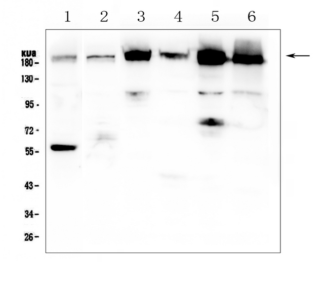 ITGA1/CD49a/Integrin Alpha 1 Antibody - Western blot analysis of Integrin alpha 1 using anti-Integrin alpha 1 antibody. Electrophoresis was performed on a 5-20% SDS-PAGE gel at 70V (Stacking gel) / 90V (Resolving gel) for 2-3 hours. The sample well of each lane was loaded with 50ug of sample under reducing conditions. Lane 1: human placenta tissue lysates,Lane 2: rat lung tissue lysates,Lane 3: mouse spleen tissue lysates,Lane 4: mouse heart tissue lysates,Lane 5: mouse lung tissue lysates,Lane 6: mouse ovary tissue lysates. After Electrophoresis, proteins were transferred to a Nitrocellulose membrane at 150mA for 50-90 minutes. Blocked the membrane with 5% Non-fat Milk/ TBS for 1.5 hour at RT. The membrane was incubated with rabbit anti-Integrin alpha 1 antigen affinity purified polyclonal antibody at 0.5 µg/mL overnight at 4°C, then washed with TBS-0.1% Tween 3 times with 5 minutes each and probed with a goat anti-rabbit IgG-HRP secondary antibody at a dilution of 1:10000 for 1.5 hour at RT. The signal is developed using an Enhanced Chemiluminescent detection (ECL) kit with Tanon 5200 system. A specific band was detected for Integrin alpha 1 at approximately 200KD. The expected band size for Integrin alpha 1 is at 131KD.