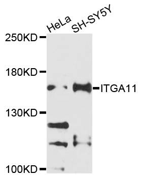ITGA11 / Integrin Alpha 11 Antibody - Western blot analysis of extracts of various cell lines, using ITGA11 antibody at 1:1000 dilution. The secondary antibody used was an HRP Goat Anti-Rabbit IgG (H+L) at 1:10000 dilution. Lysates were loaded 25ug per lane and 3% nonfat dry milk in TBST was used for blocking. An ECL Kit was used for detection and the exposure time was 90s.