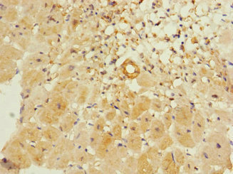 ITGA11 / Integrin Alpha 11 Antibody - Immunohistochemistry of paraffin-embedded human heart tissue at dilution 1:100