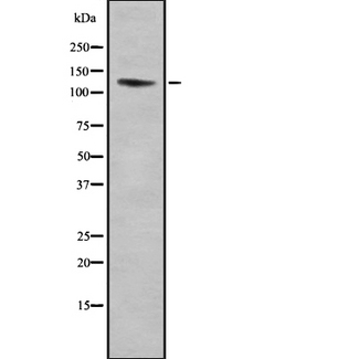 ITGA11 / Integrin Alpha 11 Antibody - Western blot analysis ITGA11 using A549 whole cells lysates
