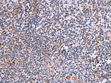 ITGA11 / Integrin Alpha 11 Antibody - Immunohistochemistry of paraffin-embedded Human tonsil tissue  using ITGA11 Polyclonal Antibody at dilution of 1:75(×200)