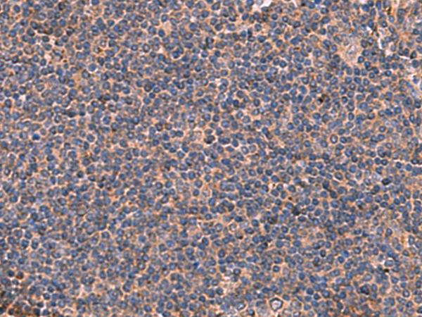 ITGA11 / Integrin Alpha 11 Antibody - Immunohistochemistry of paraffin-embedded Human tonsil tissue  using ITGA11 Polyclonal Antibody at dilution of 1:50(×200)
